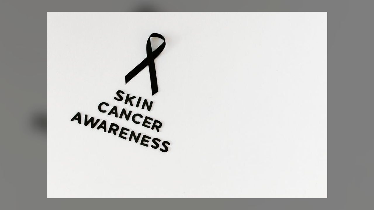Melanoma maligno: sintomas, diagnóstico e tratamento explicados por especialistas